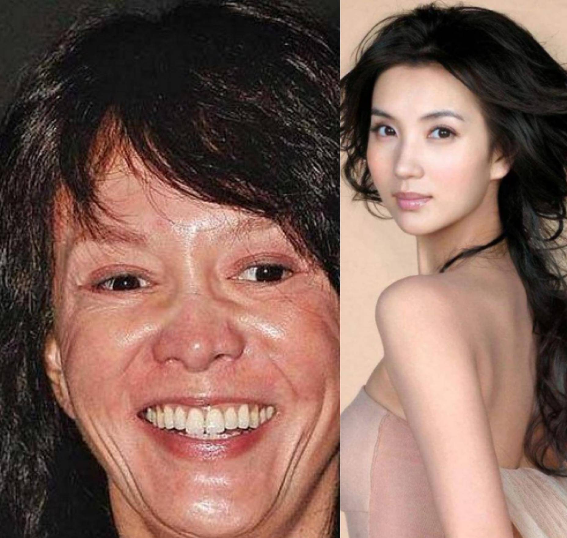 那些整容的明星，揭秘背后的故事，揭秘整容明星背后的故事